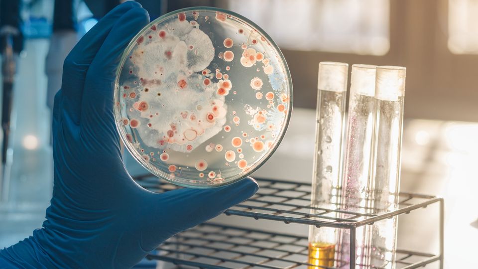 Heating Erlenmeyer Flask Bacterial Culture | Shaanxi Achieve chem-tech Heating Erlenmeyer Flask Bacterial Culture | Shaanxi Achieve chem-tech
